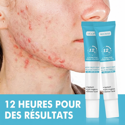 Gel Anti-Acné & Imperfections à l’Acide Salicylique – Unisexe
