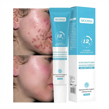 Gel Anti-Acné & Imperfections à l’Acide Salicylique – Unisexe