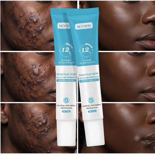 Gel Anti-Acné & Imperfections à l’Acide Salicylique – Unisexe