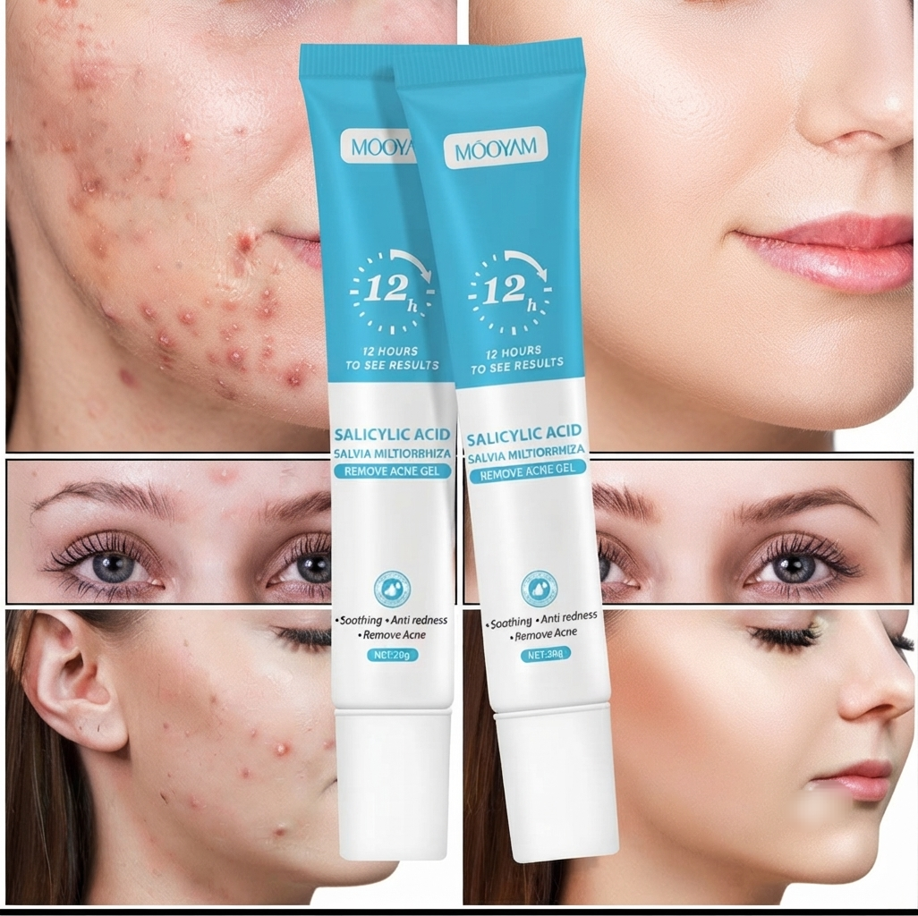 Gel Anti-Acné & Imperfections à l’Acide Salicylique – Unisexe